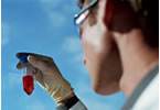 blood sample